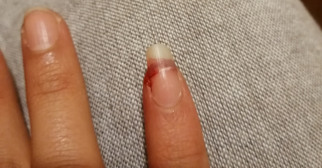 my nail broke really far down