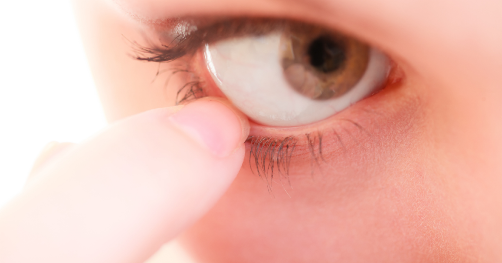 How to Identify An Ingrown Eyelash?