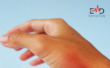 Can Cellulitis Kill You? can cellulitis kill you