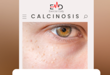 Calcium Deposits on Eyelids and Skin