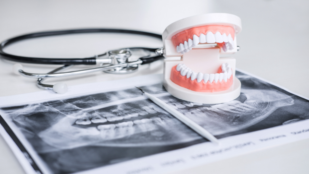 tooth sensitivity months after filling