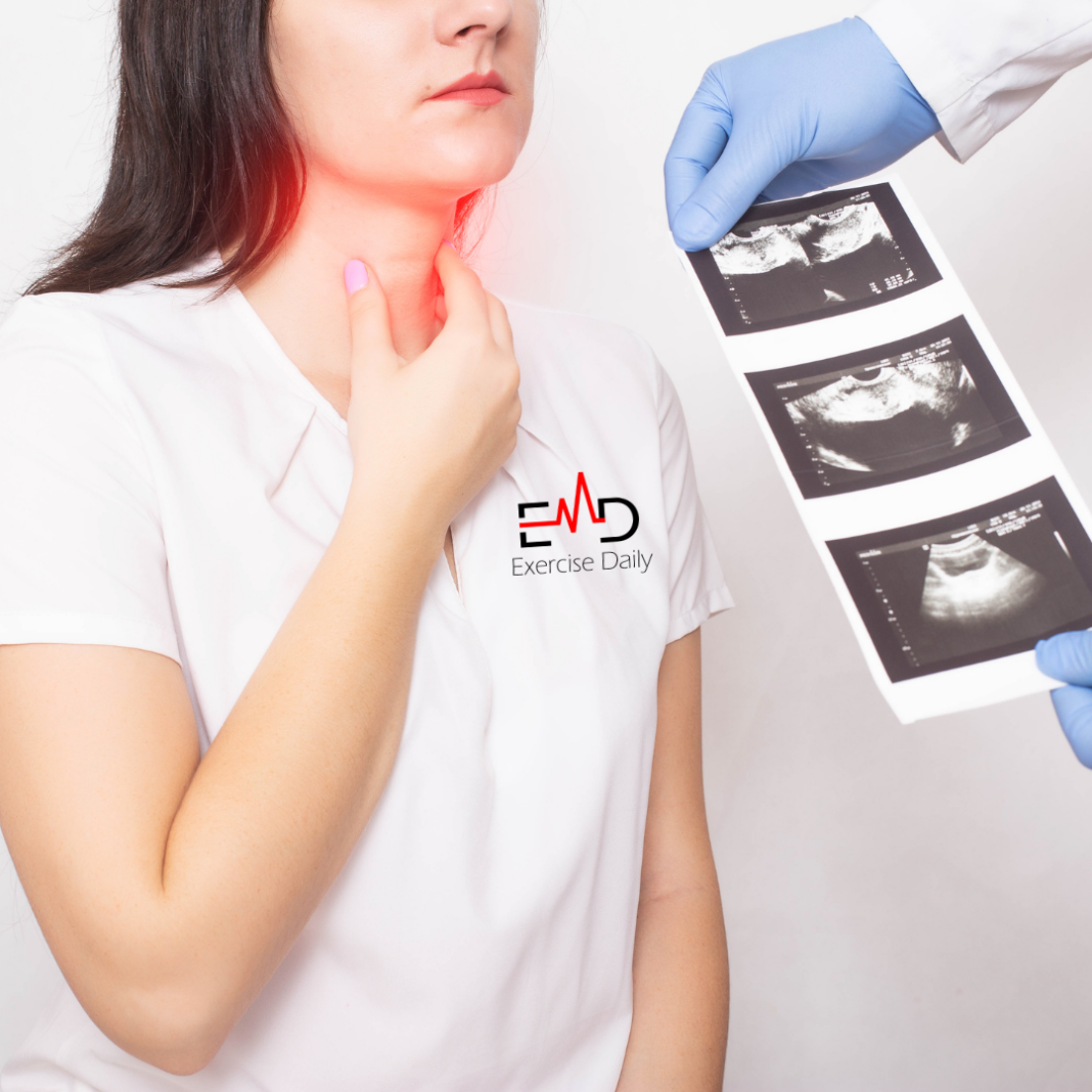 Hypothyroidism Diet Plan for Weight Loss Hypothyroidism-Diet-Plan-for-Weight-Loss