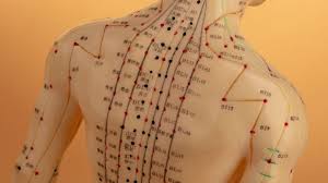 Acupuncture