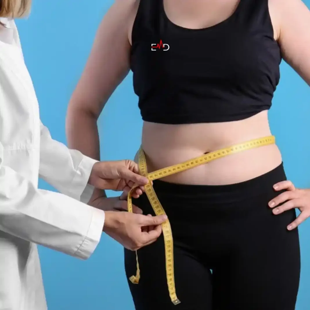 Picture of Weight Loss and Mental Health; Connection & How to Stay Positive